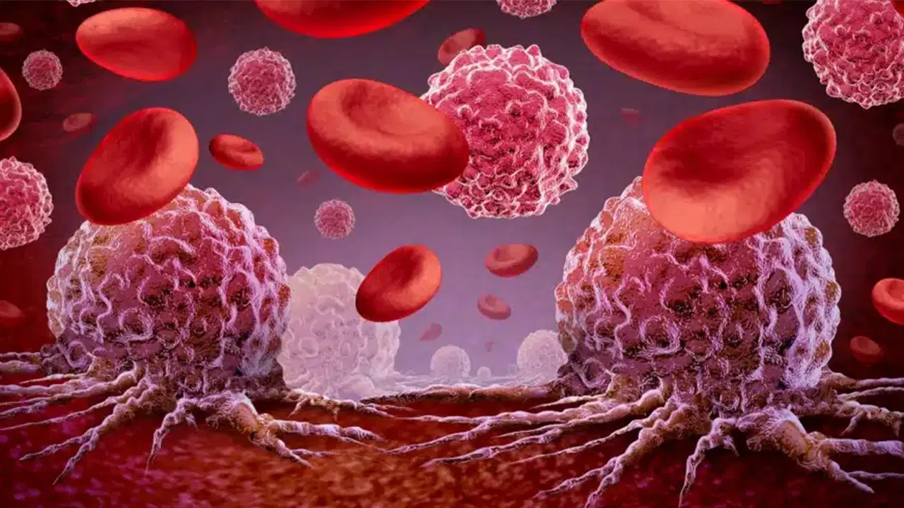 lenfoma erken teshisle buyuk oranda tedavi edilebiliyor rZtmXEZx