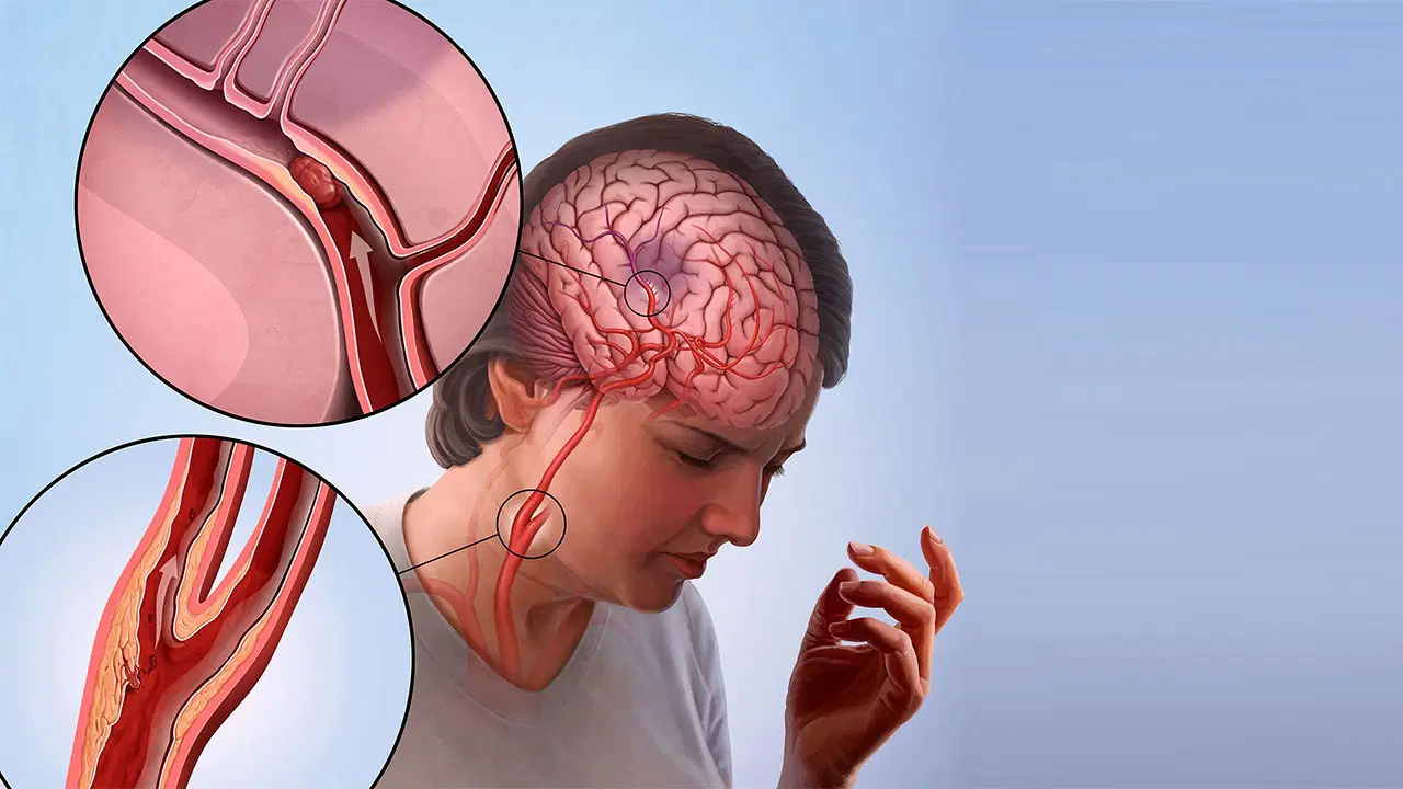 turkiyede bu sebepten dolayi her yil 45 bin insan oluyor JJlyAM98